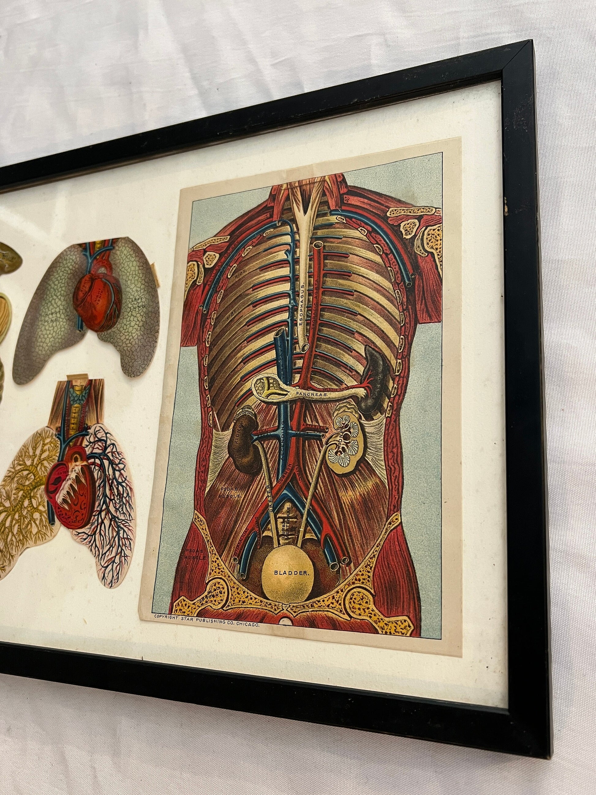 Vintage Framed Biology Stomach Lungs Print | International Reference Work | International Publishing Company | Home Decor