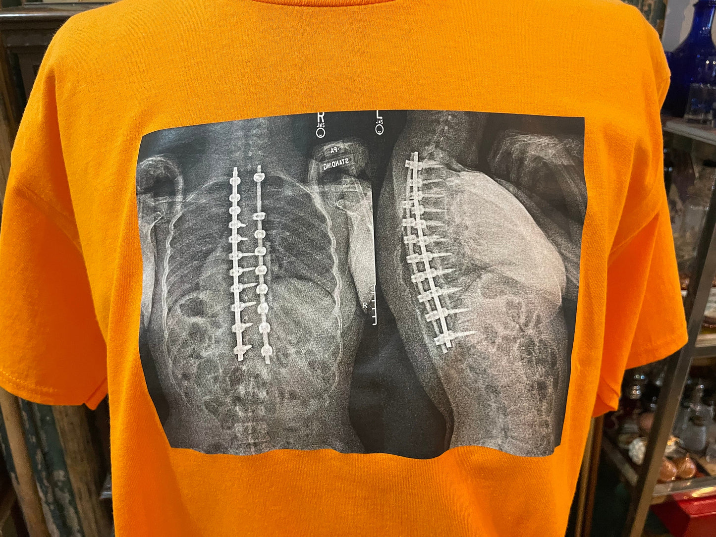 Collect T-Shirt with X-Rays Graphic