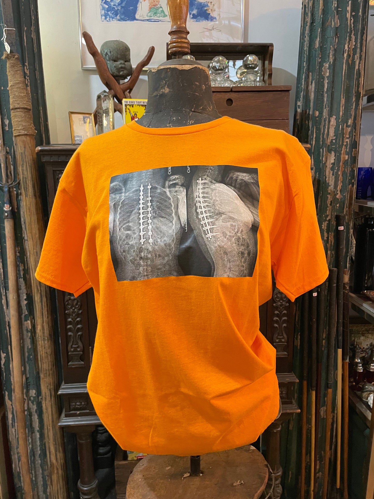 Collect T-Shirt with X-Rays Graphic