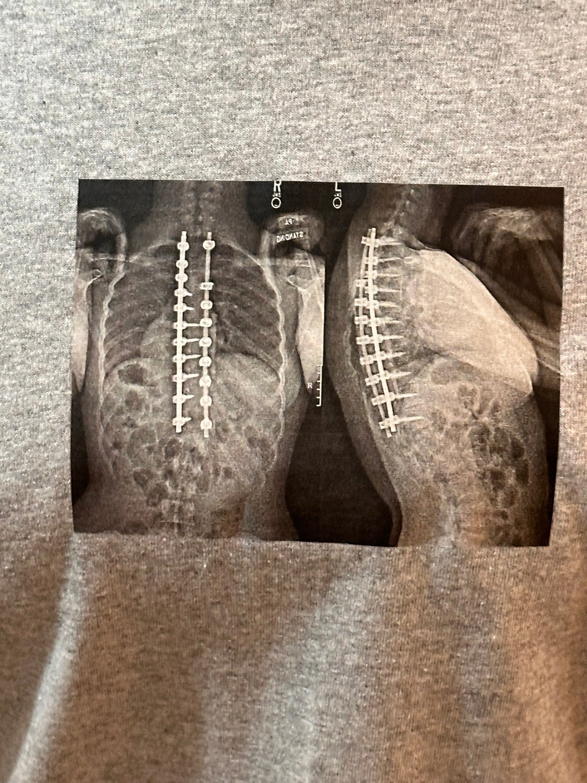 Collect Long Sleeve Top with X-Rays Graphic