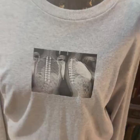 Collect Long Sleeve Top with X-Rays Graphic